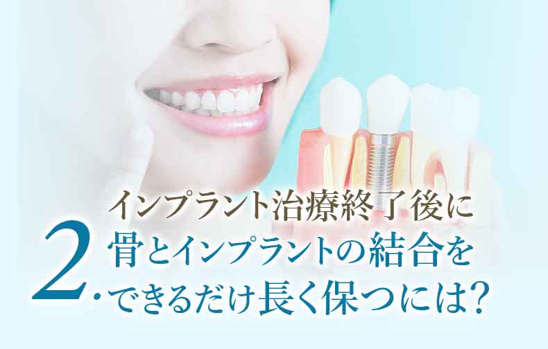 インプラント治療終了後に骨とインプラントの結合を できるだけ長く保つには?