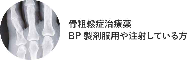 骨粗鬆症治療薬BP製剤服用や注射している方