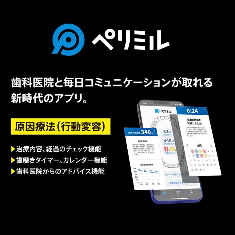 歯周病治療サポートアプリ 「ぺリミル」